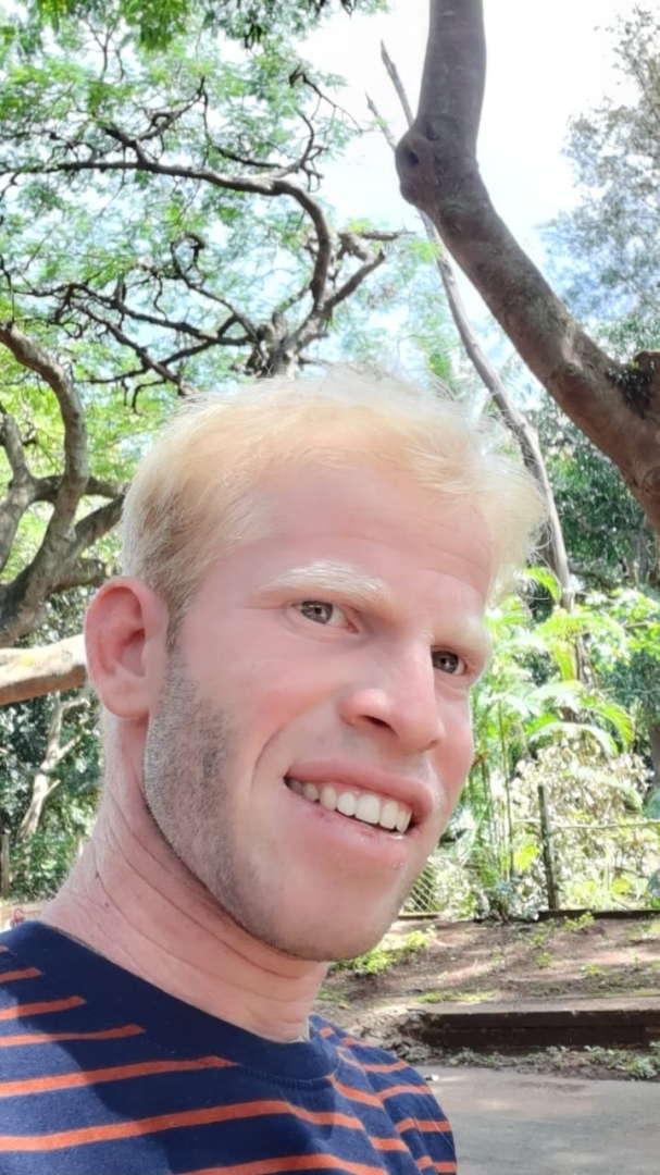 Faced with albinism, visual impairment at birth,   twin brothers hail NAB for giving them a shot at life