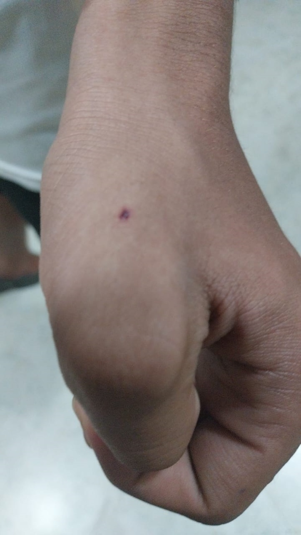 Three bitten by dog at Fatorda