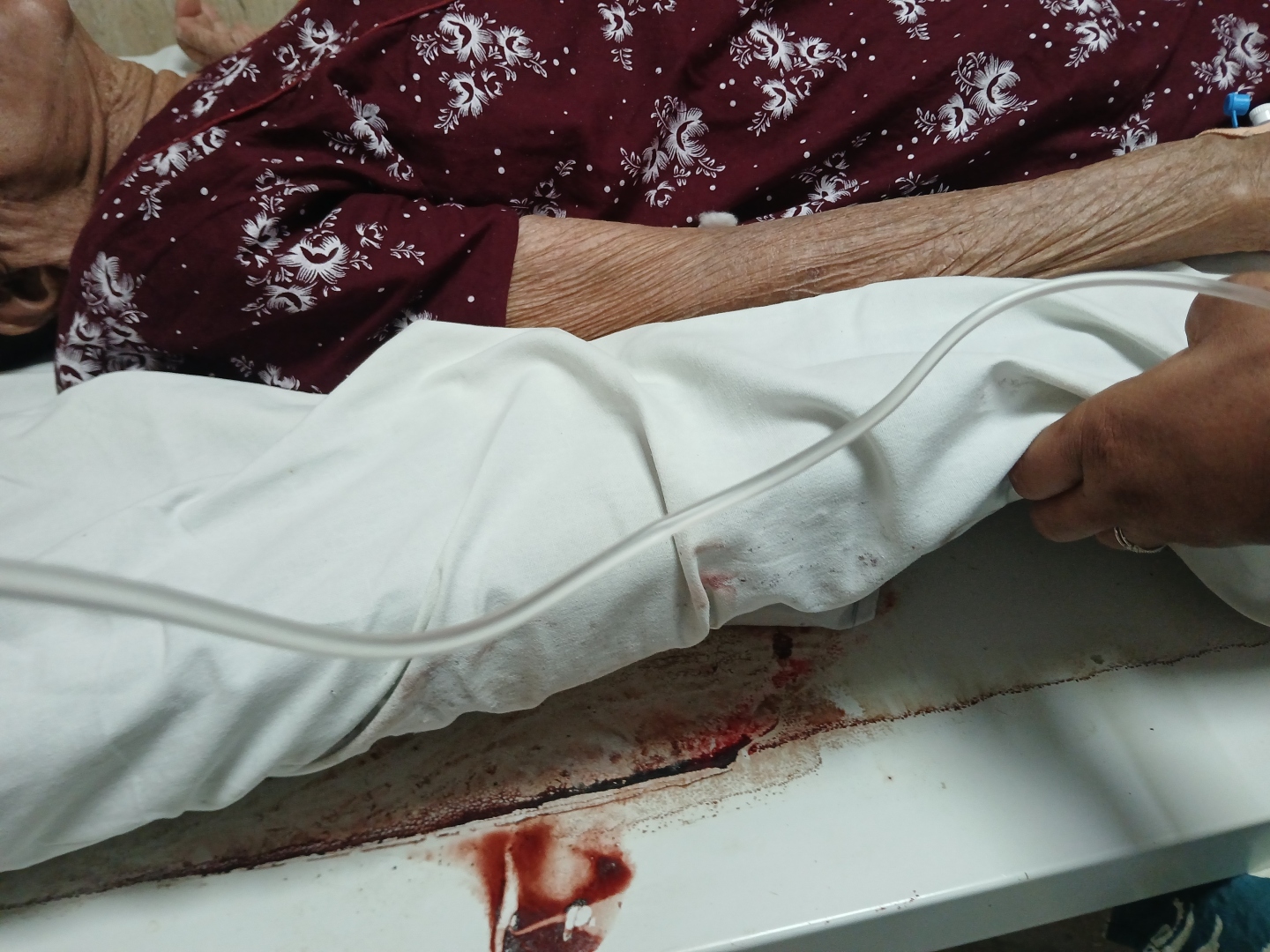 Patient's ordeal exposes deeper issues at SGDH