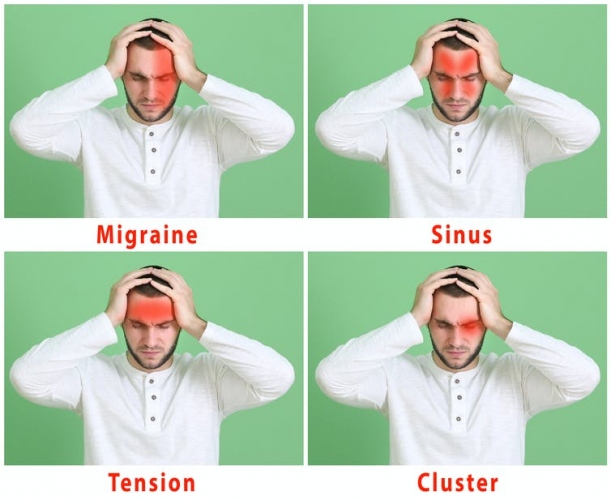 ﻿Headaches: 3 tips from a neuroscientist on how to get rid of them
