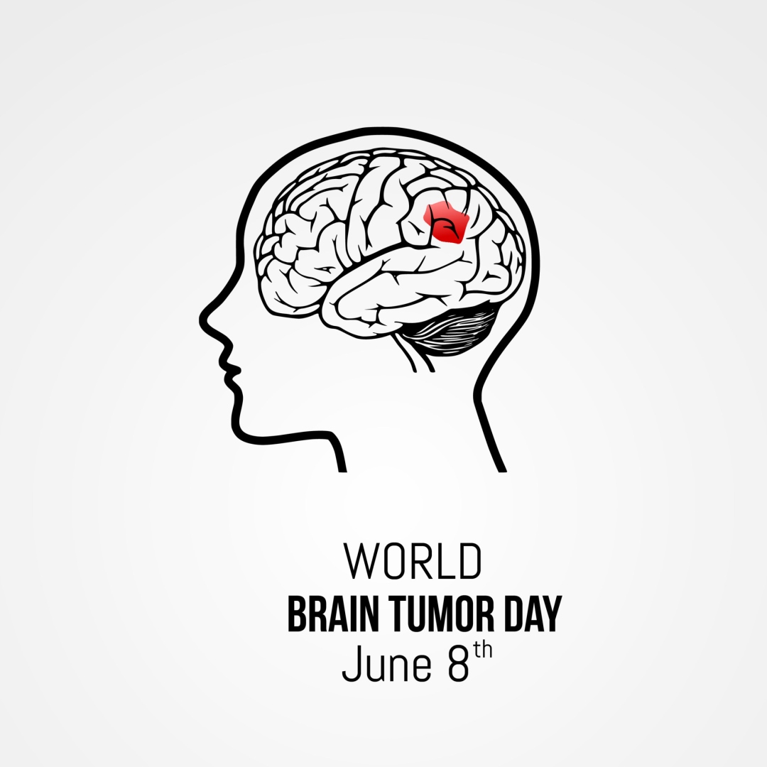 ﻿World Brain Tumour Day: Critical to promote awareness about brain tumours to dispel myths