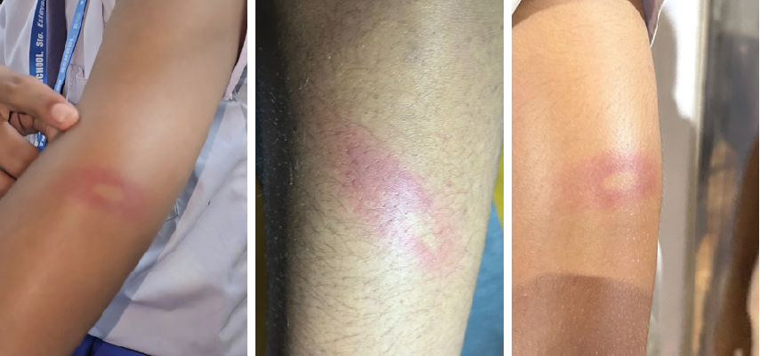 St Estevam school teacher assaults 11 Std 9 students